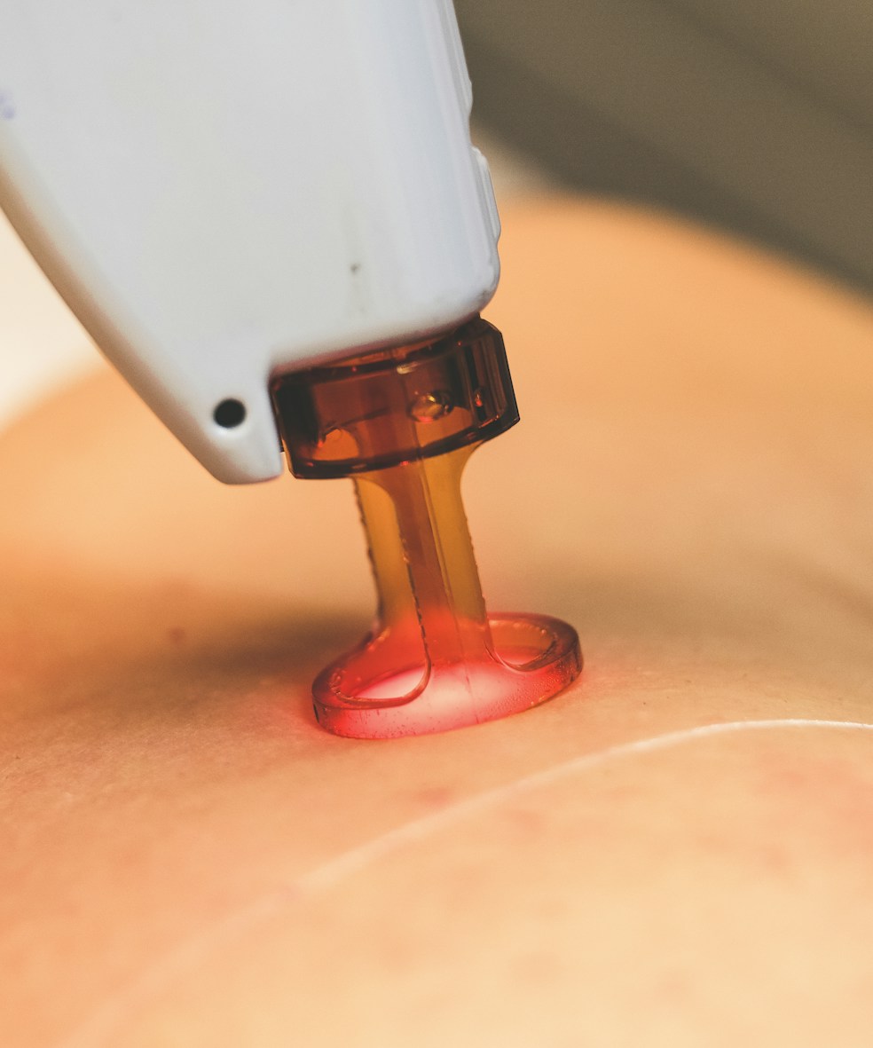 Close-up of advanced stem cell therapy equipment in use.